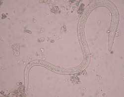 5 Things You Didn't Know About Beneficial Nematodes