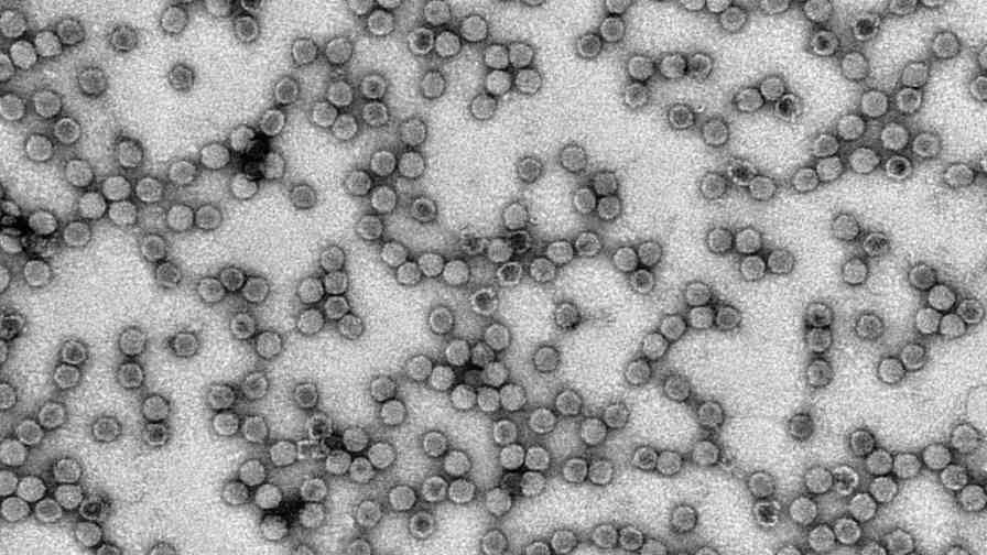 Even with powerful electron microscopes, viruses cannot be identified based on particle shape. Pictured here are particles of tomato apex necrosis virus. Photo credit: B. W. Falk 