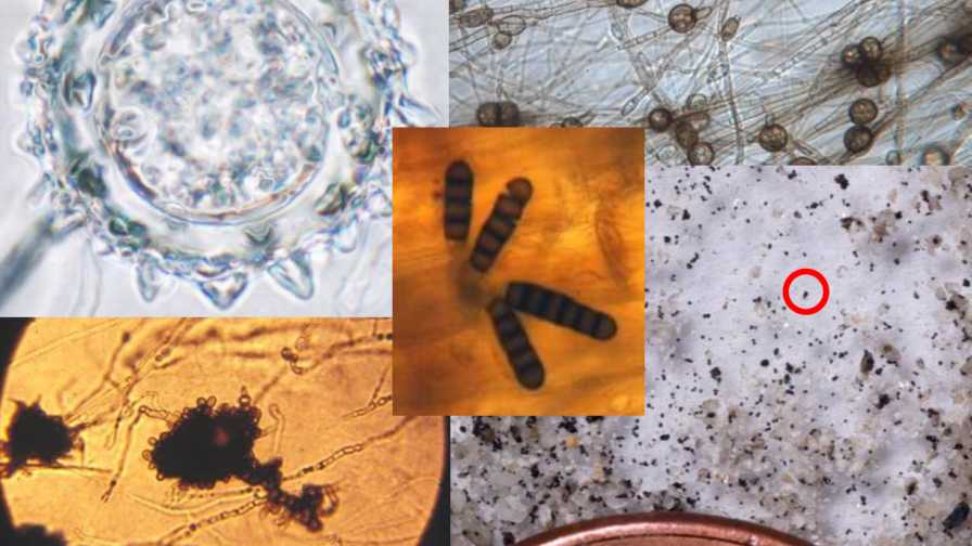 Collage of soil microbes up close