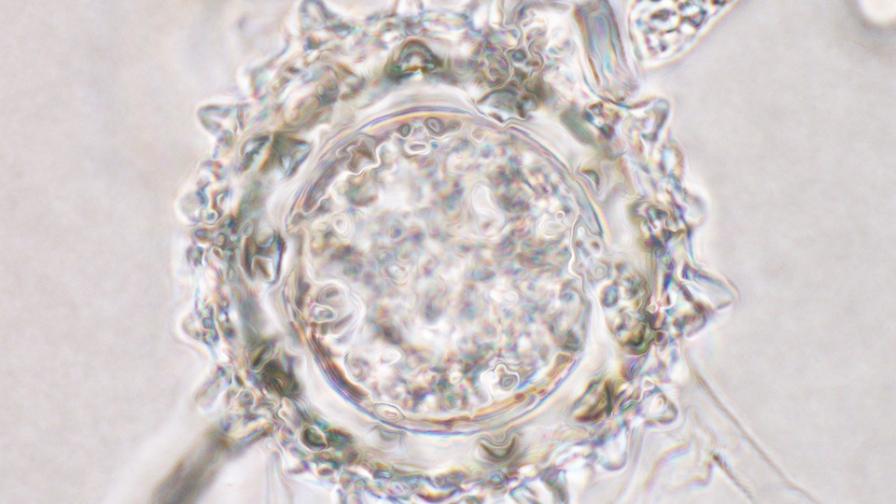 Pythium under a microscope