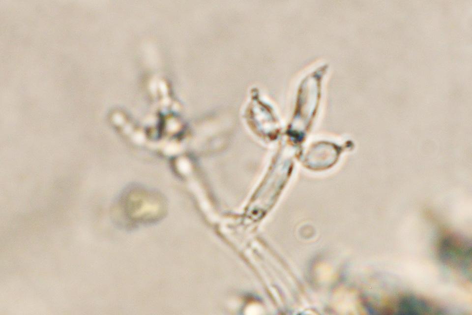 Trichoderma spores under microscope